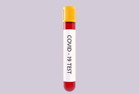 Covid-19: ANS determina inclusão de testes sorológicos no Rol de Procedimentos